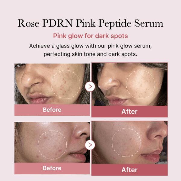 Medicube Korean PDRN Pink Peptide Serum 30 ml